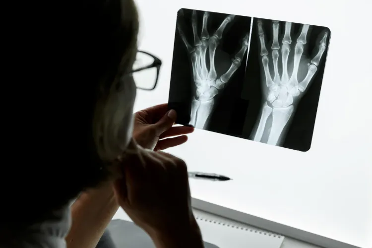 Hand xray image